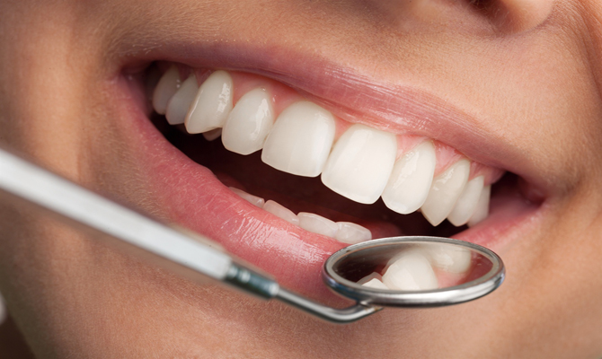 Simple Steps For Keeping Teeth Healthy